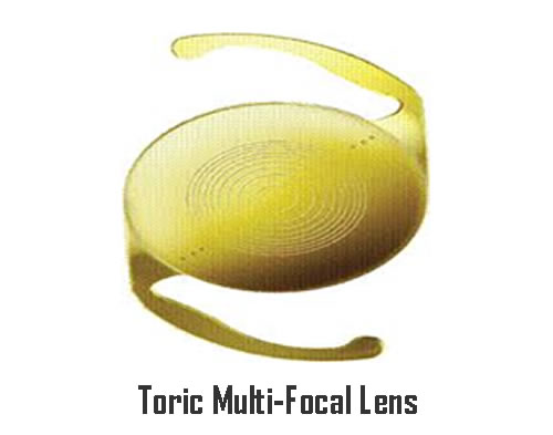 Toric Multi-Focal Lens